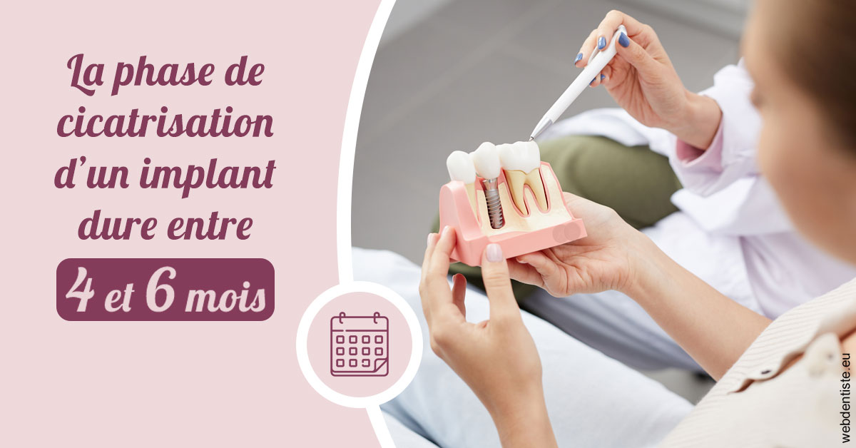 https://scp-cabinet-dentaire-drs-abehsera.chirurgiens-dentistes.fr/Cicatrisation implant 2