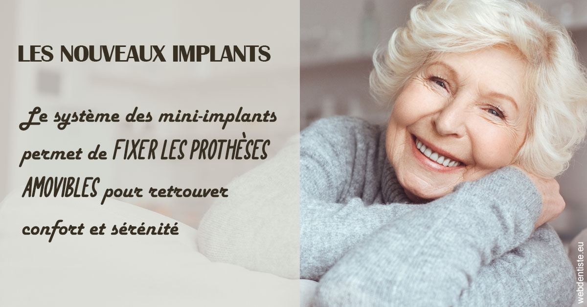https://scp-cabinet-dentaire-drs-abehsera.chirurgiens-dentistes.fr/Les nouveaux implants 1