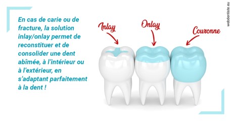 https://scp-cabinet-dentaire-drs-abehsera.chirurgiens-dentistes.fr/L'INLAY ou l'ONLAY