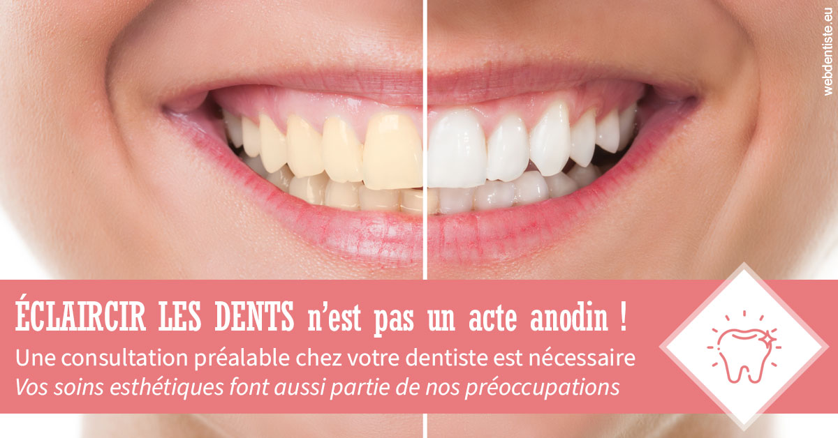 https://scp-cabinet-dentaire-drs-abehsera.chirurgiens-dentistes.fr/Eclaircir les dents 1