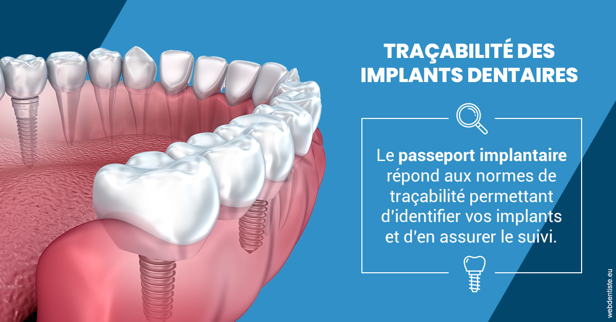 https://scp-cabinet-dentaire-drs-abehsera.chirurgiens-dentistes.fr/T2 2023 - Traçabilité des implants 1