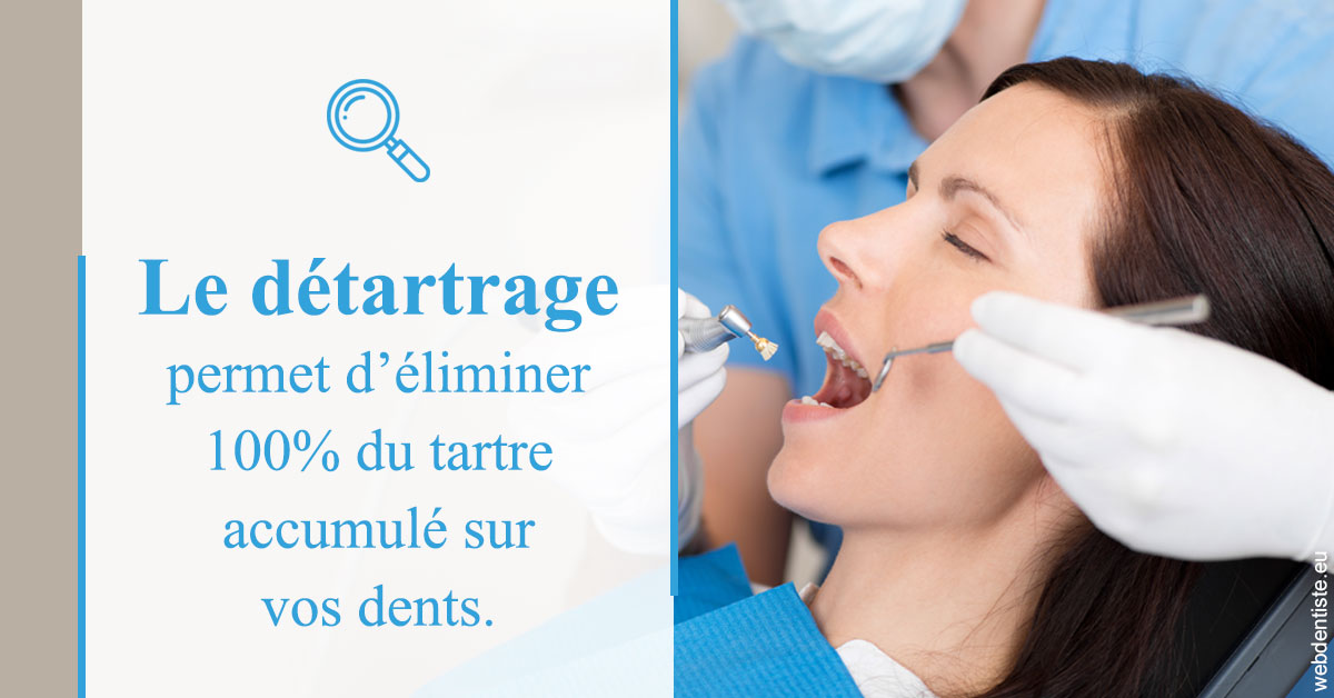 https://scp-cabinet-dentaire-drs-abehsera.chirurgiens-dentistes.fr/En quoi consiste le détartrage