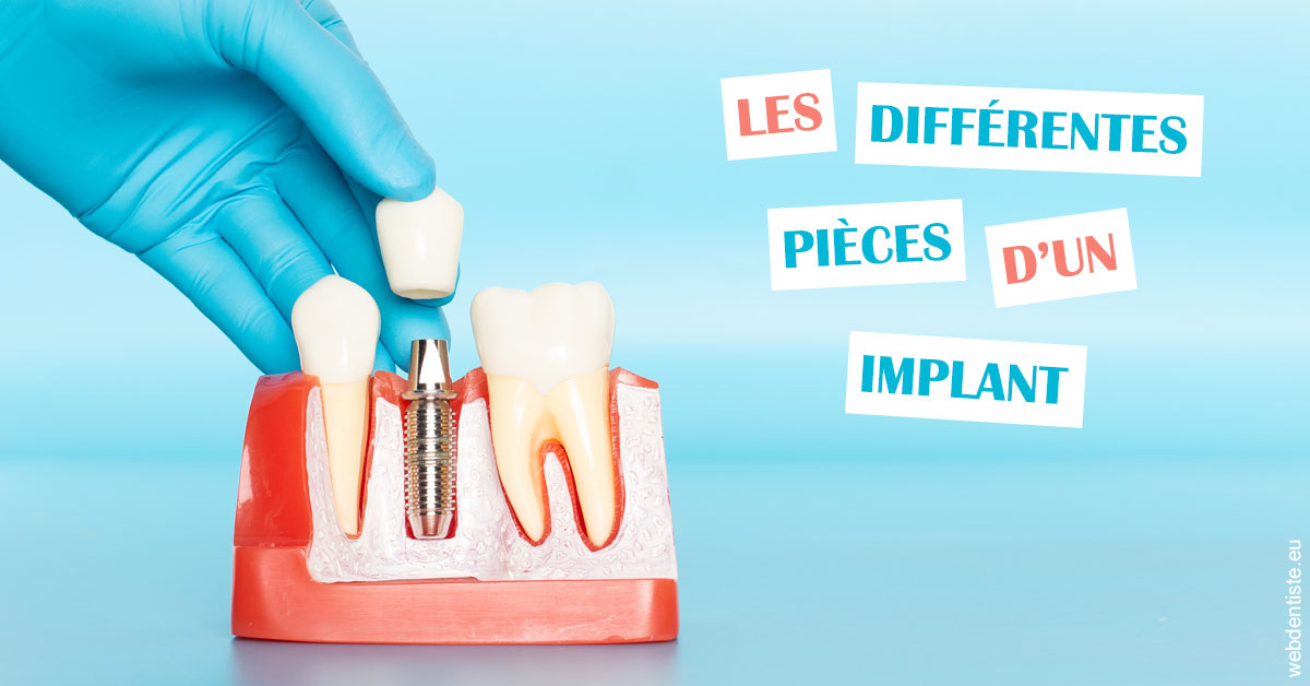 https://scp-cabinet-dentaire-drs-abehsera.chirurgiens-dentistes.fr/Les différentes pièces d’un implant 2