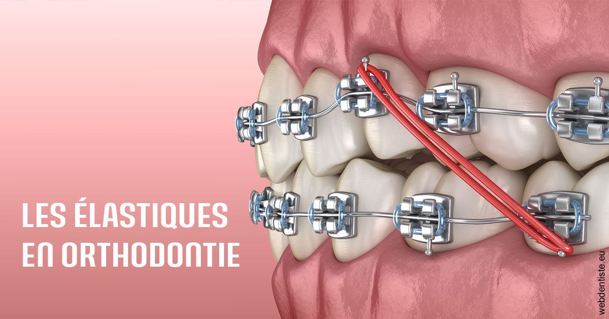 https://scp-cabinet-dentaire-drs-abehsera.chirurgiens-dentistes.fr/Elastiques orthodontie 2