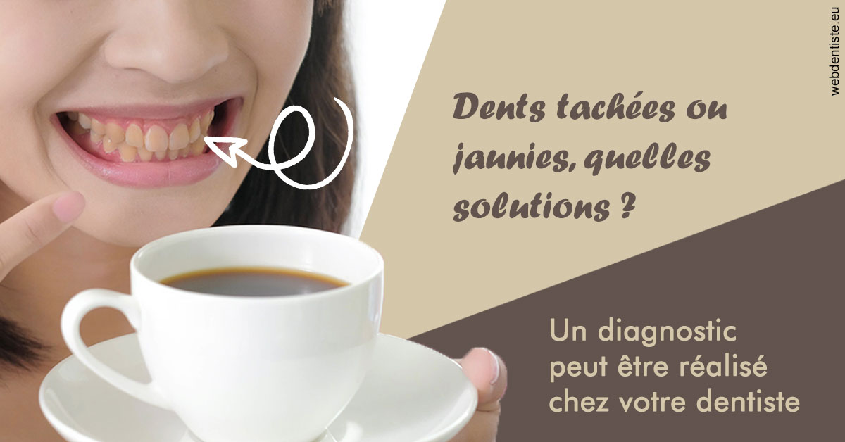 https://scp-cabinet-dentaire-drs-abehsera.chirurgiens-dentistes.fr/Dents tachées 1