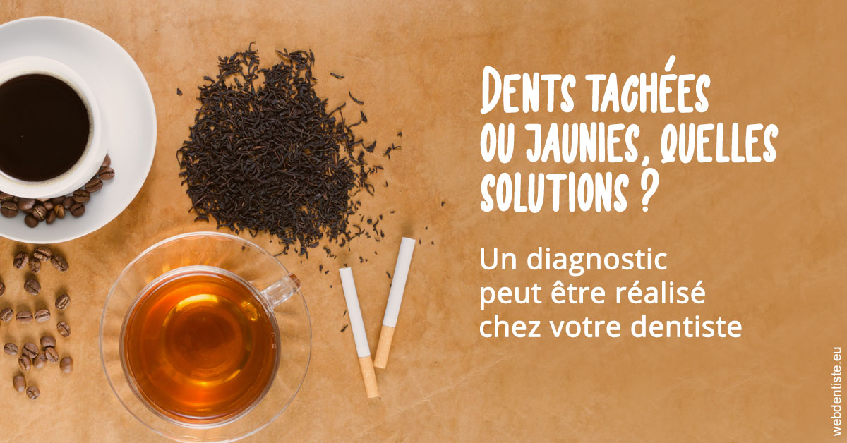 https://scp-cabinet-dentaire-drs-abehsera.chirurgiens-dentistes.fr/Dents tachées 2